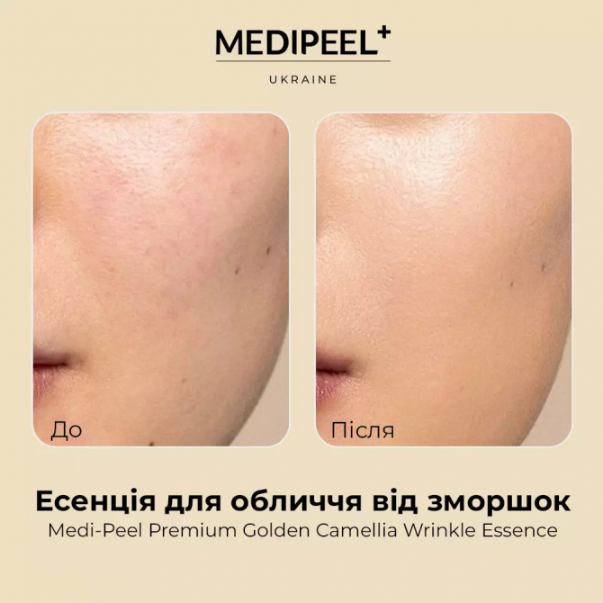 Антивікова есенція із золотою камелією та ферментованим комплексом MEDI-PEEL Premium Golden Camellia Wrinkle Essense 50 мл купити в Україні 3