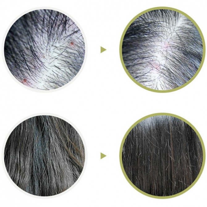 Пилинг для кожи головы Lador Scalp Scaling Spa Hair Ampoule 15 мл купить в Украине 4