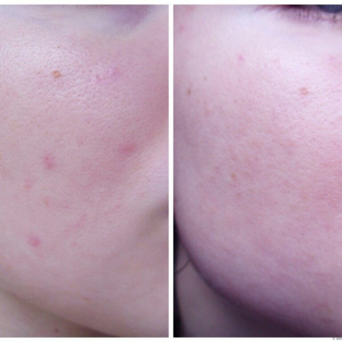 Кислотна пілінг-сироватка AHA 8% MIZON Peeling Serum 50 мл купити в Україні 3