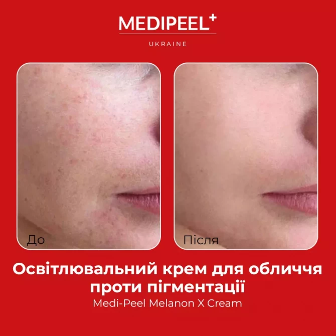 Освітлюючий крем проти пігментації MEDI-PEEL Melanon Cream 30 мл купити в Україні 3