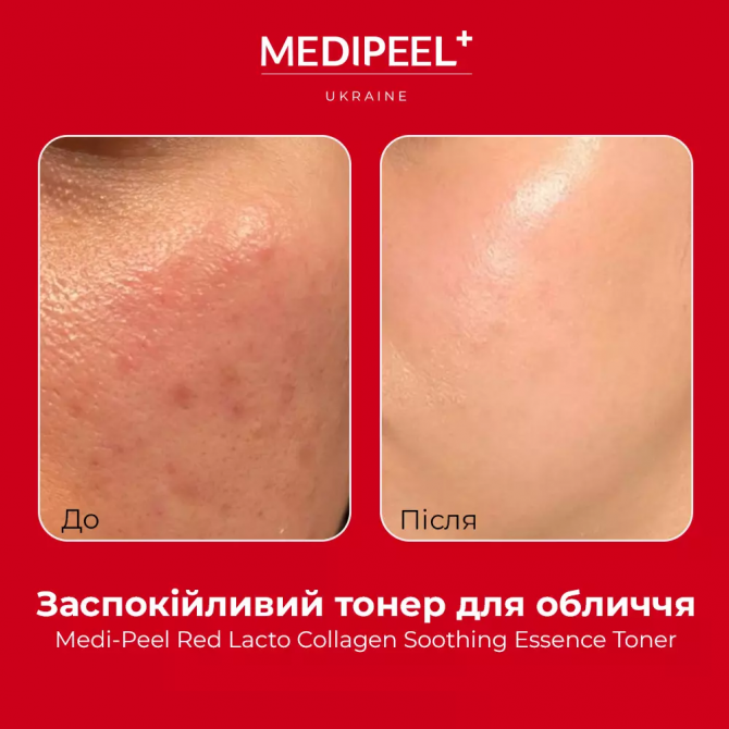 Заспокійливий тонер для обличчя з колагеном MEDI-PEEL Red Lacto Collagen Soothing Essence Toner 200 мл купити в Україні 3