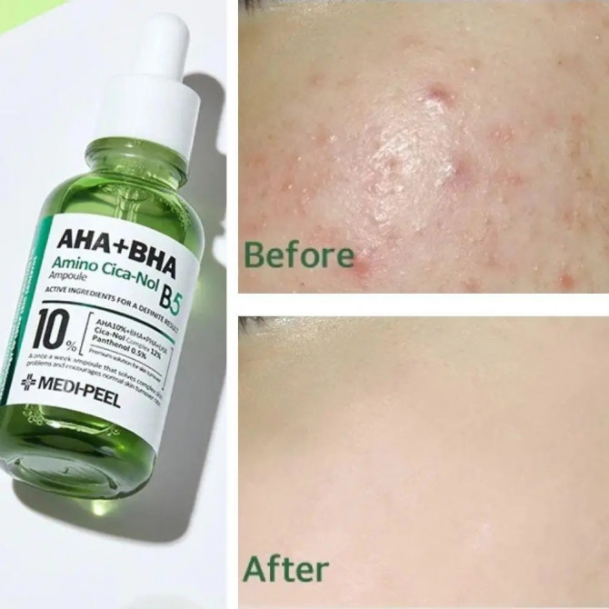 Відлущувальна сироватка для обличчя з центелою та кислотами MEDI-PEEL AHA BHA Amino Cica-Nol B5 Ampoule 30 мл купити в Україні 2