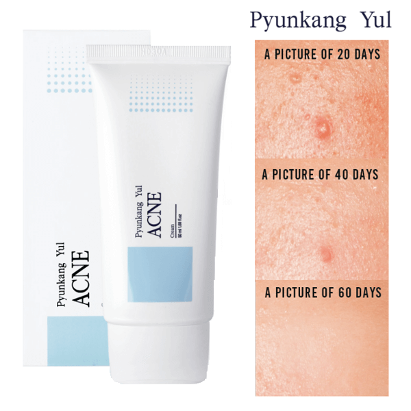 Крем для лікування акне Pyunkang Yul ACNE Cream 50 мл купити в Україні 4