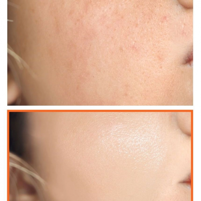 Мило з ефектом освітлення з вітаміном С SOME BY MI Pure Vitamin C V10 Cleansging Bar 106 г купити в Україні 2