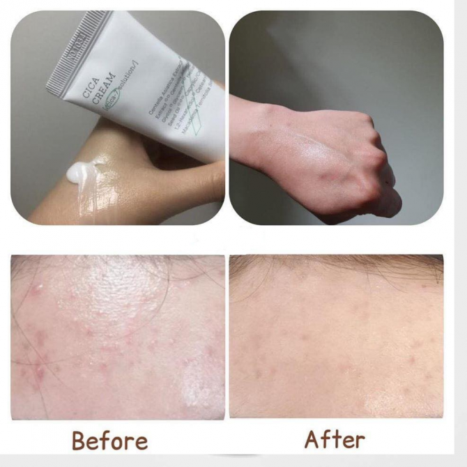 Успокаивающий крем с центеллой COSRX Pure Fit Cica Cream 50 мл купить в Украине 3