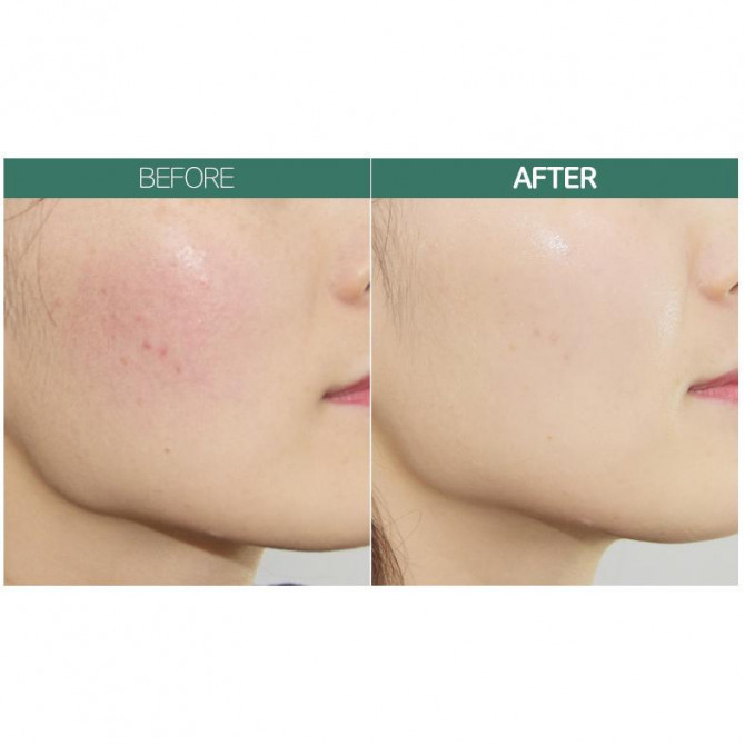 Відновлювальна емульсія з алое Holika Holika Aloe Soothing Essence 90% Emulsion Calming 200 мл купити в Україні 4