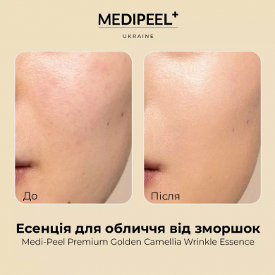 Антивікова есенція із золотою камелією та ферментованим комплексом MEDI-PEEL Premium Golden Camellia Wrinkle Essense 50 мл купити в Україні 3