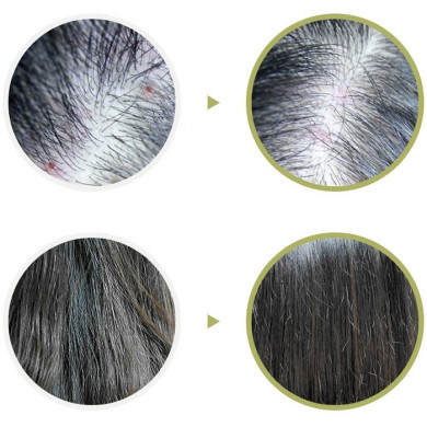 Пилинг для кожи головы Lador Scalp Scaling Spa Hair Ampoule 15 мл купить в Украине 4
