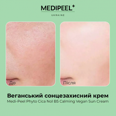 Сонцезахисний крем для обличчя з центелою MEDI-PEEL Phyto Cica Nol B5 Calming Vegan Sun Cream SPF50 50 мл купити в Україні 3