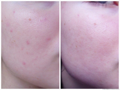 Кислотна пілінг-сироватка AHA 8% MIZON Peeling Serum 50 мл купити в Україні 3