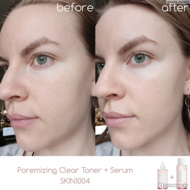 Відлущуючий тонер із центелою SKIN1004 Madagascar Centella Poremizing Clear Toner 210 мл купити в Україні 3