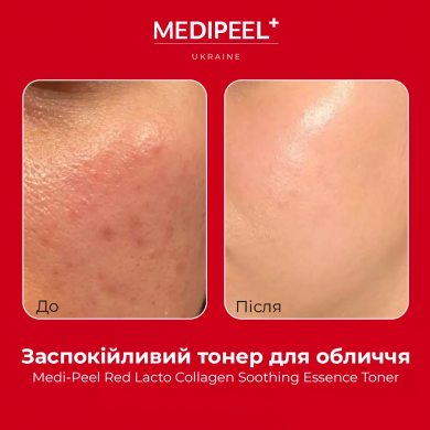 Заспокійливий тонер для обличчя з колагеном MEDI-PEEL Red Lacto Collagen Soothing Essence Toner 200 мл купити в Україні 3