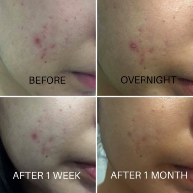 Увлажняющий крем с экстрактом центеллы для проблемной кожи, COSRX, Centella Blemish Cream, 30 мл купить в Украине 2 Увлажняющий крем с экстрактом центеллы для проблемной кожи, COSRX, Centella Blemish Cream, 30 мл купить в Украине 2
