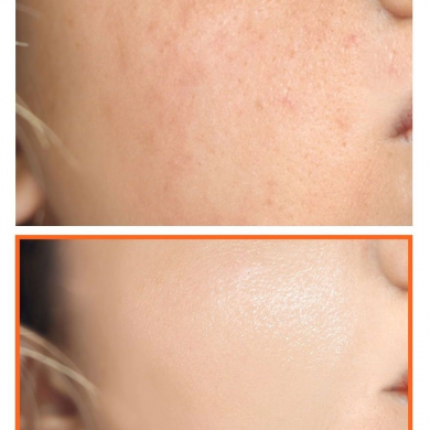 Мило з ефектом освітлення з вітаміном С SOME BY MI Pure Vitamin C V10 Cleansging Bar 106 г купити в Україні 2