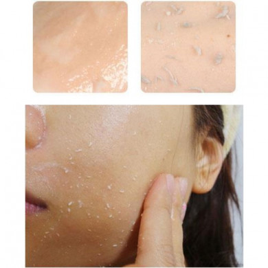 Пілінг-гель з лимоном MIZON Vita Lemon Sparkling Peeling Gel 150 мл купити в Україні 4