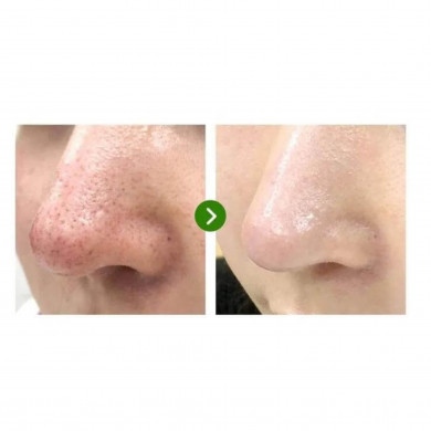 Сыворотка для сужения пор с чаем матча SOMEBYMI Super Matcha Pore Tightening Serum 50 мл купить в Украине 2