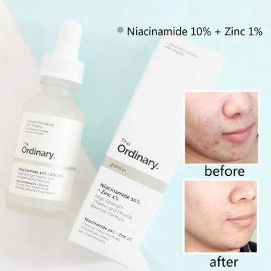 Осветляющая сыворотка с ниацинамидом 10% и цинком 1% The Ordinary Niacinamide 10% + Zinc 1% 30 мл купить в Украине 4